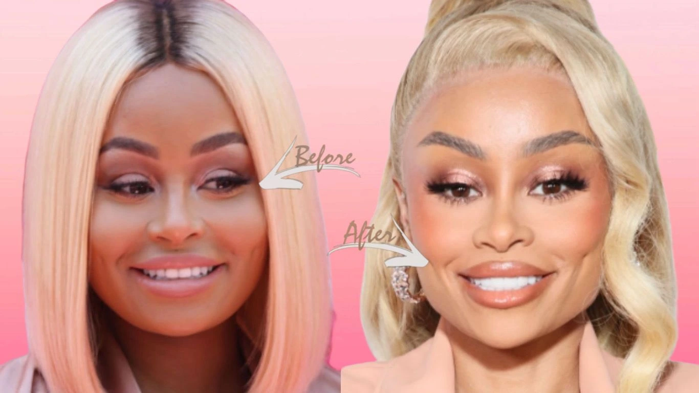 blac chyna before after