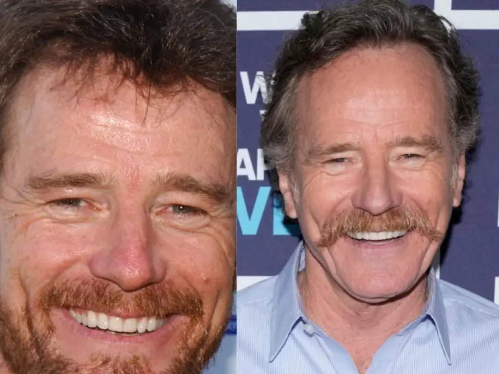 dientes de bryan cranston antes y después