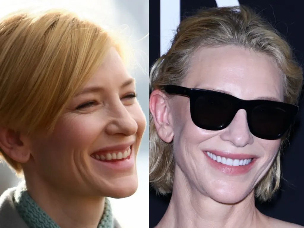 cate blanchett zähne vorher nachher