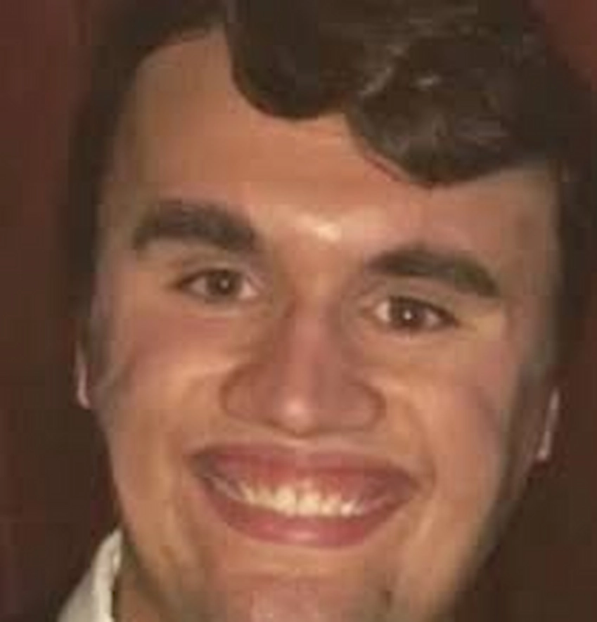 charlie kirk teeth