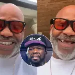 dame dash teeth