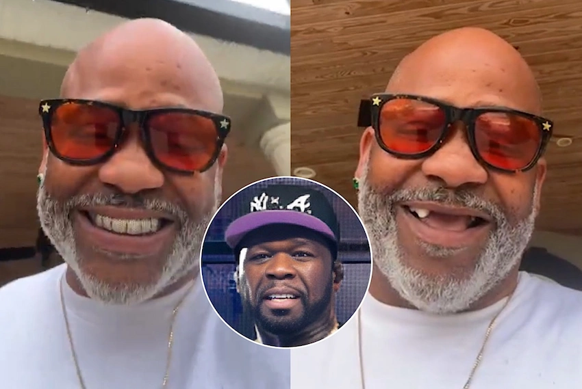 dame dash teeth