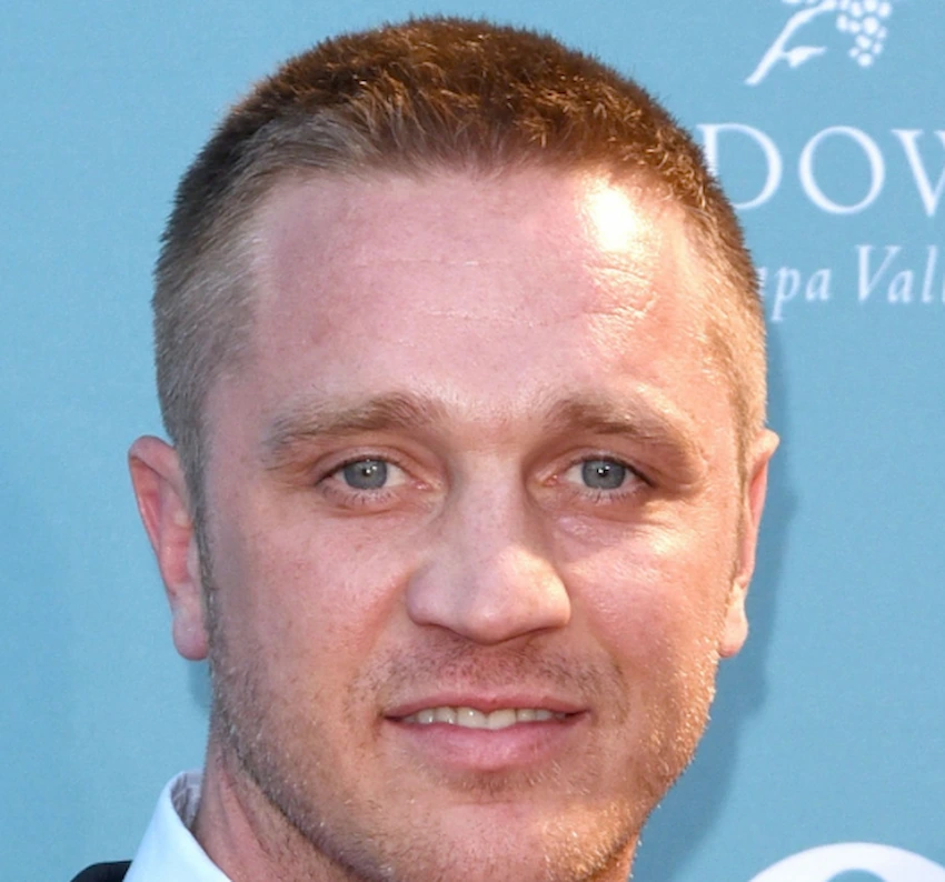 devon sawa teeth 2015