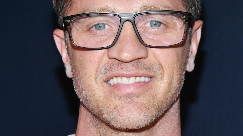 devon sawa teeth before after