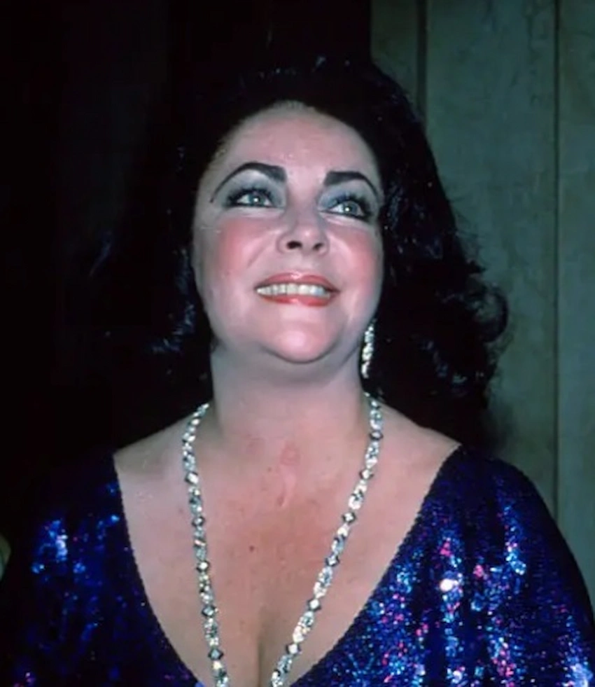 dents d'elizabeth taylor 1980