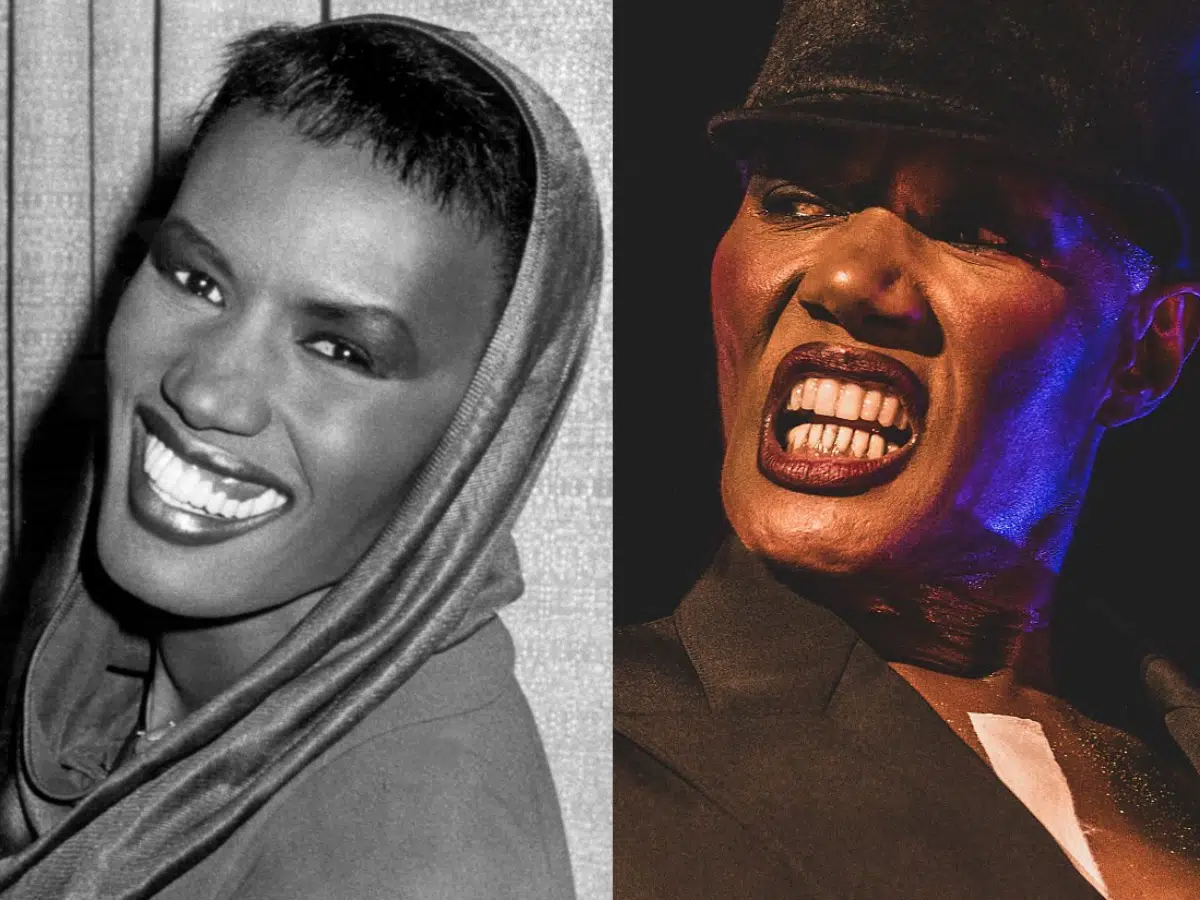 grac jones teeth before after