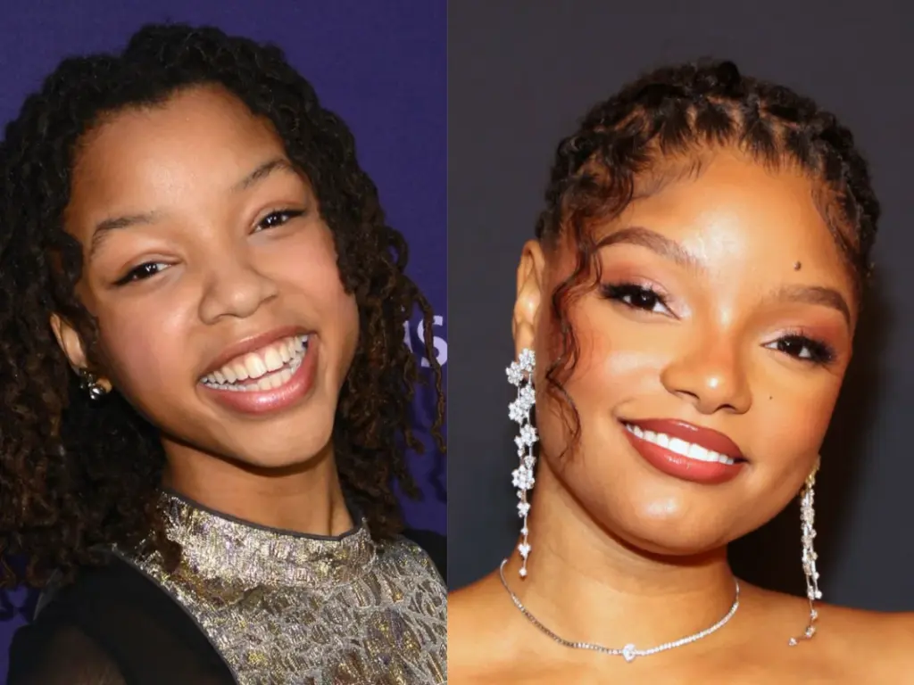 halle bailey teeth before after