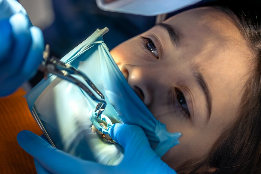 как удаляются амальгамовые пломбы