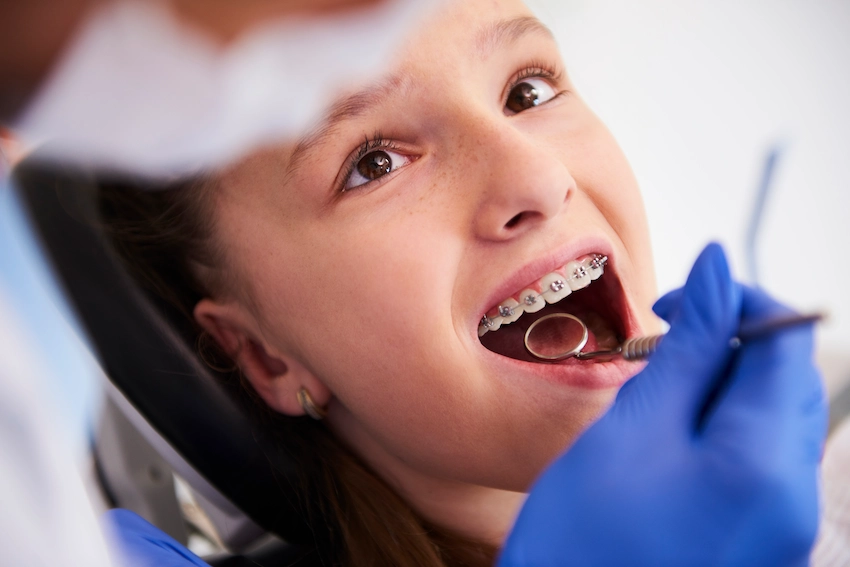 braces take to straighten teeth for child