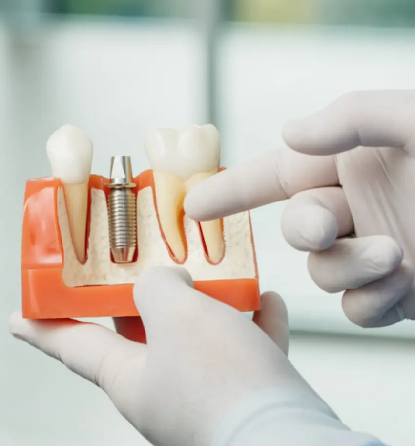 implant