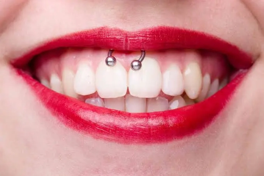 is a smiley piercing harmful to the gums