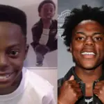 ishowspeed teeth before after