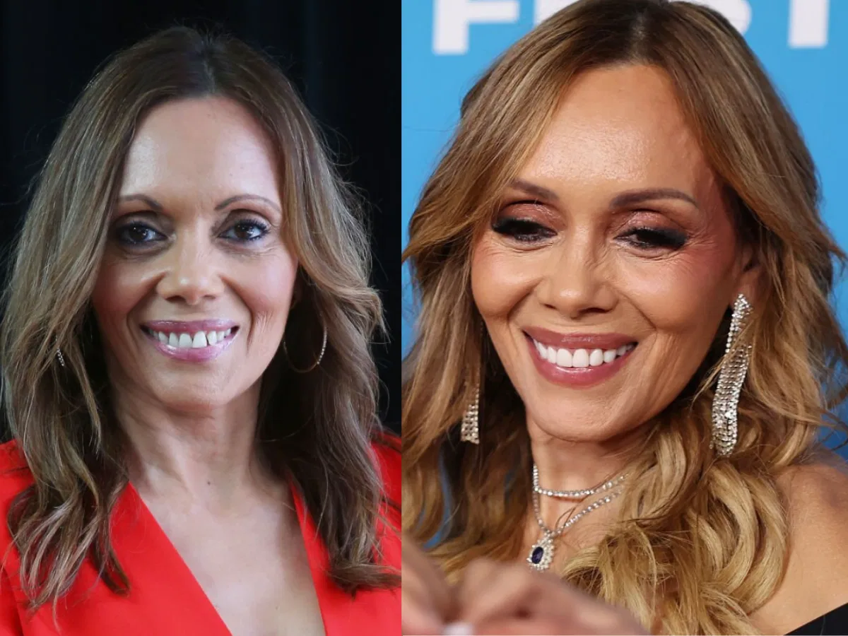 karla grant teeth before after