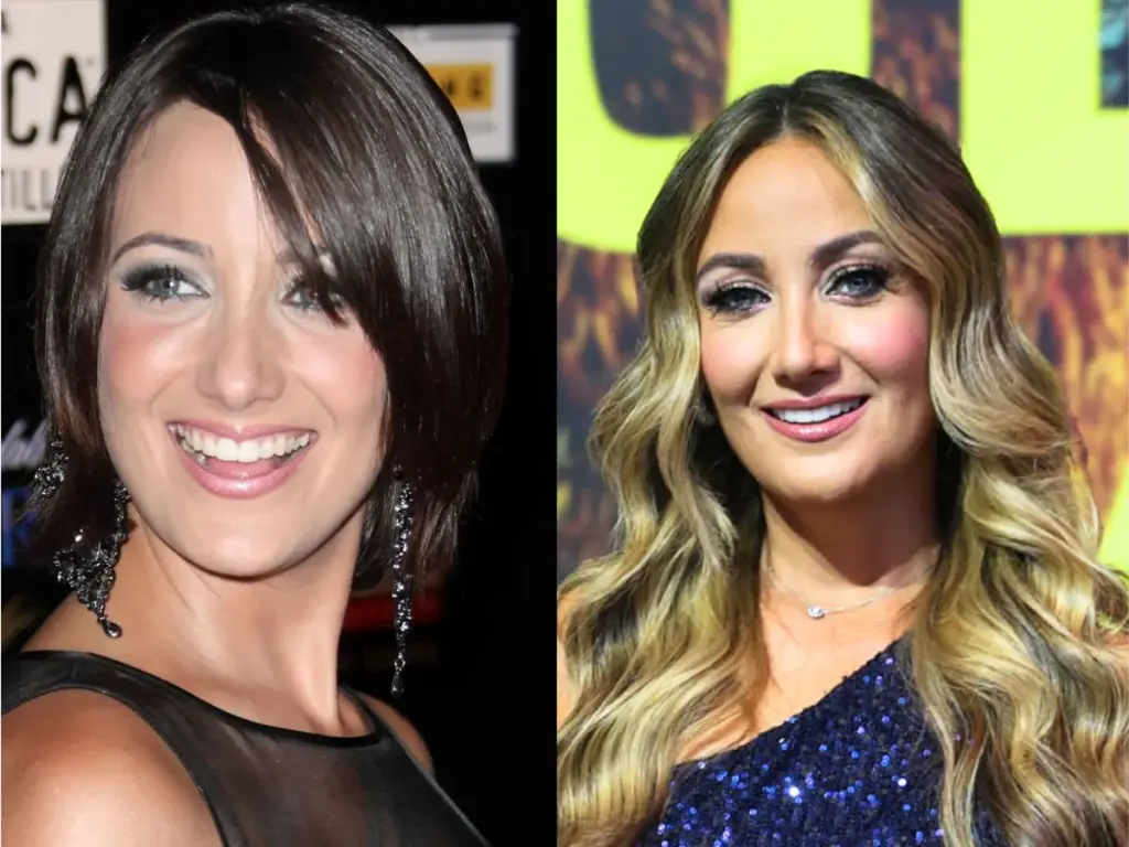 karla monroig teeth before after