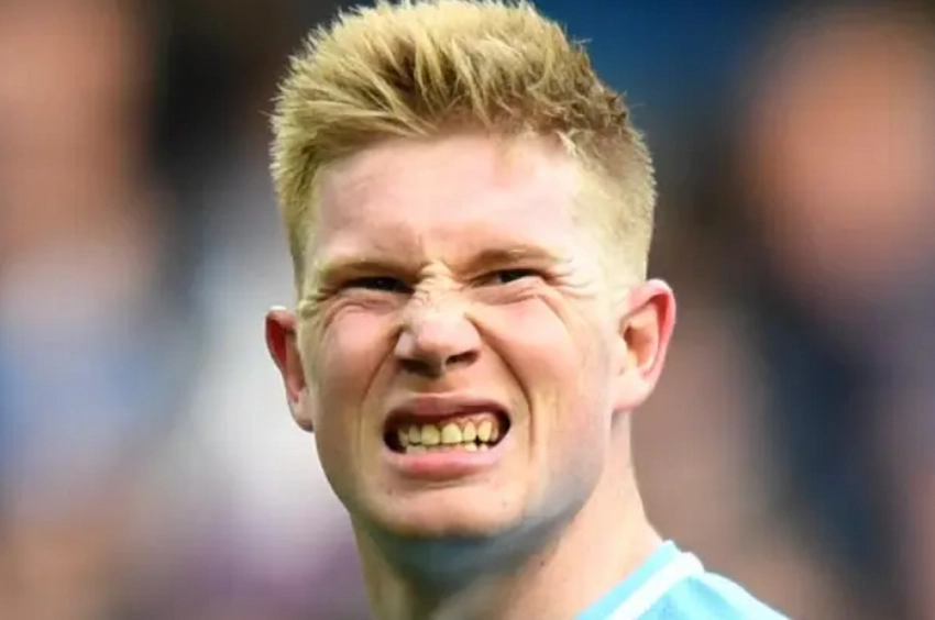 kevin de bruyne tanden 2018
