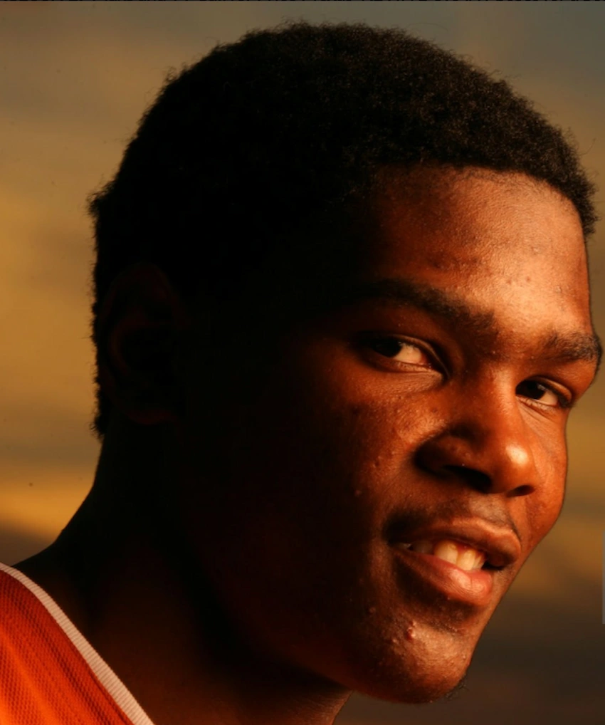 kevin durant teeth 2006