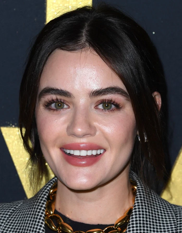 les dents de lucy hale en 2022