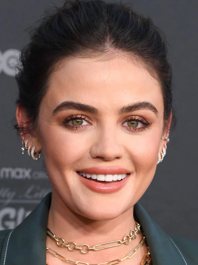 les nouvelles dents de lucy hale