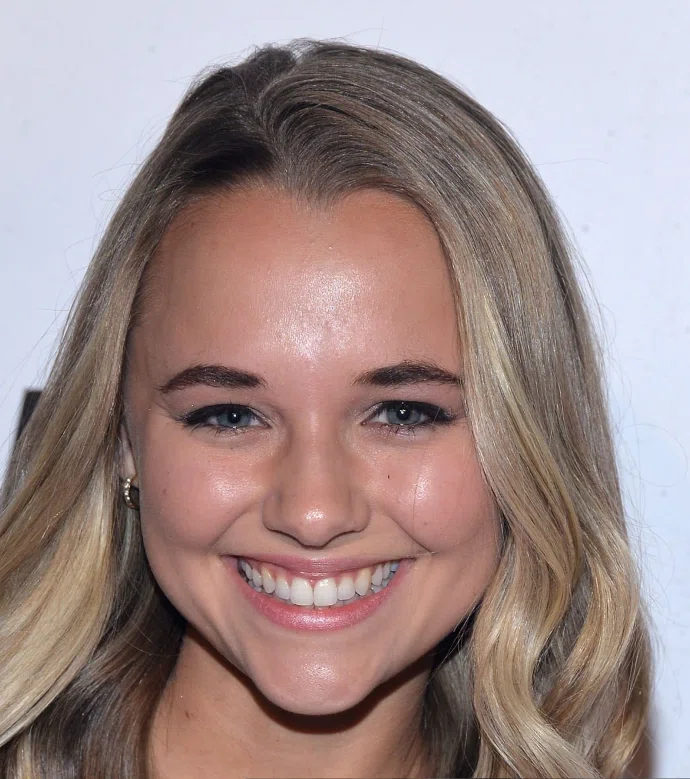 madison iseman teeth in 2015