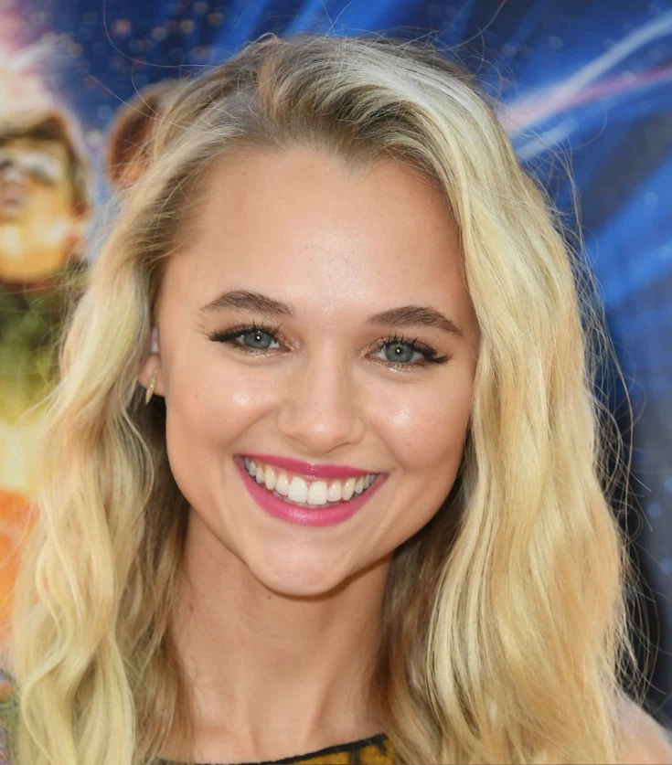 madison iseman teeth in 2018