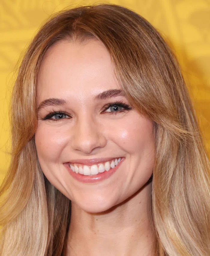 madison iseman teeth in 2023