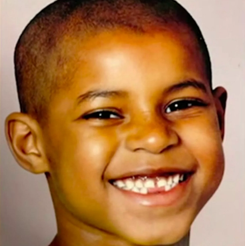 marcus rashford teeth 2008