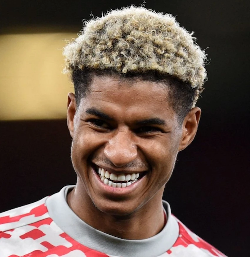 marcus rashford teeth 2020