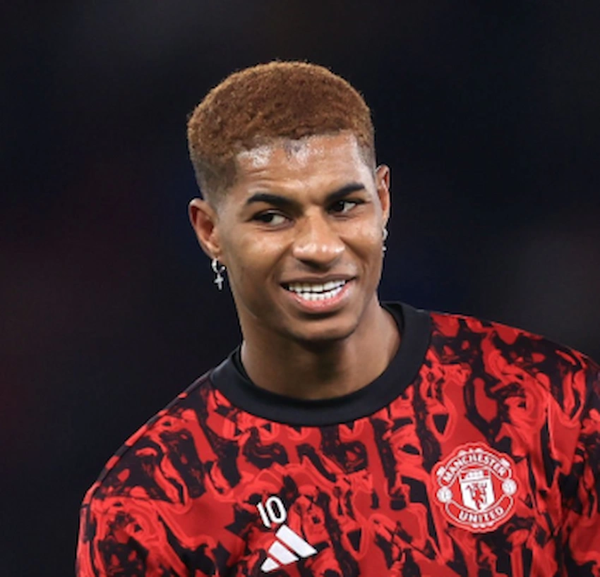 marcus rashford teeth 2023