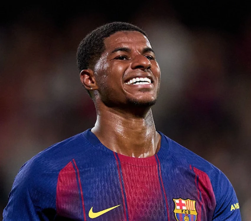 marcus rashford teeth 2025