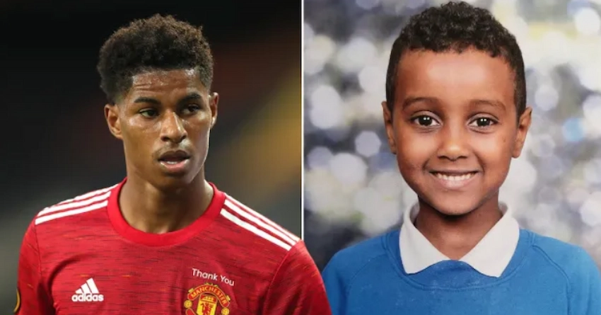 marcus rashford teeth before after