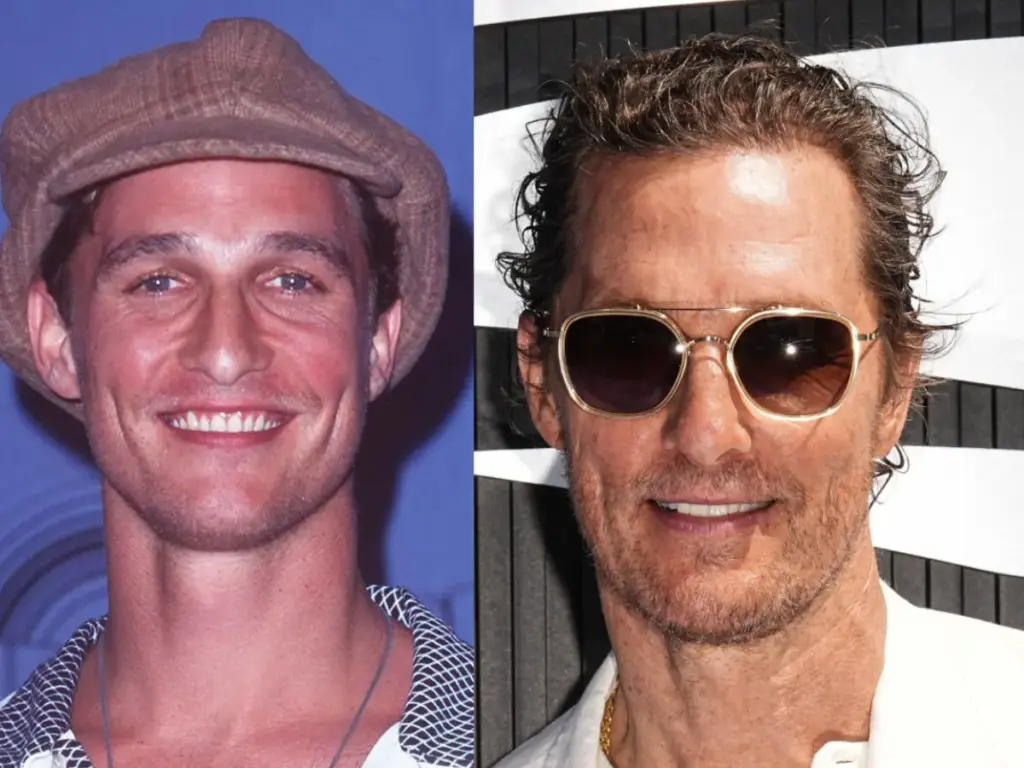 matthew mcconaughey zęby before after