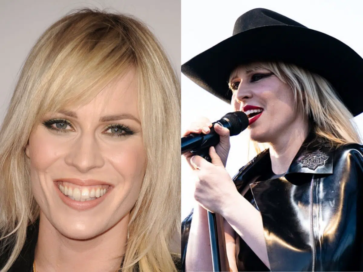 natasha bedingfield teeth before after