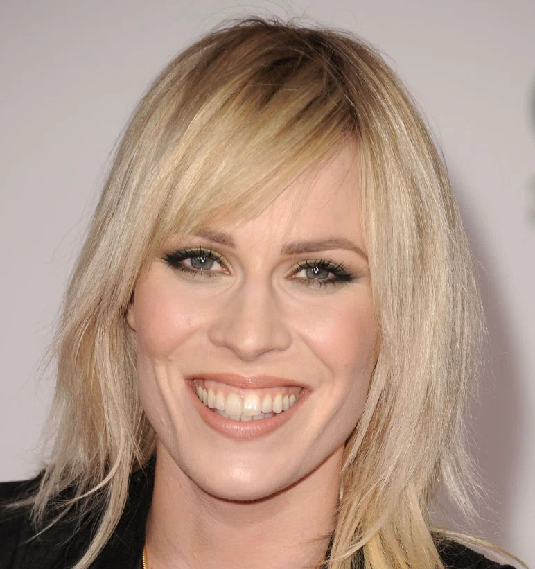 natasha bedingfield teeth in 2010