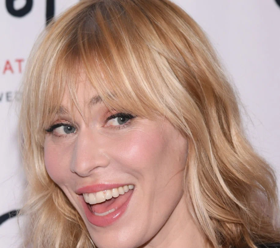 natasha bedingfield teeth in 2022