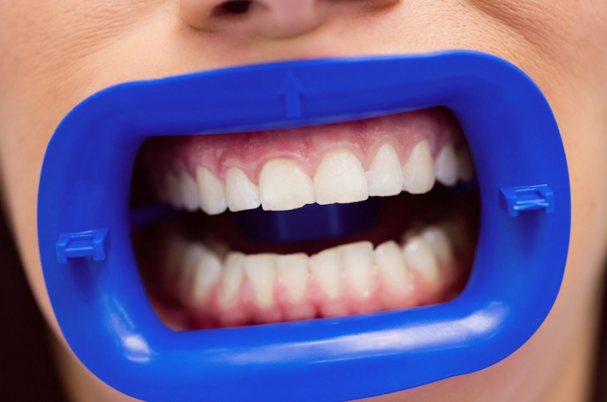 reminerales naturales para dientes qué hacen