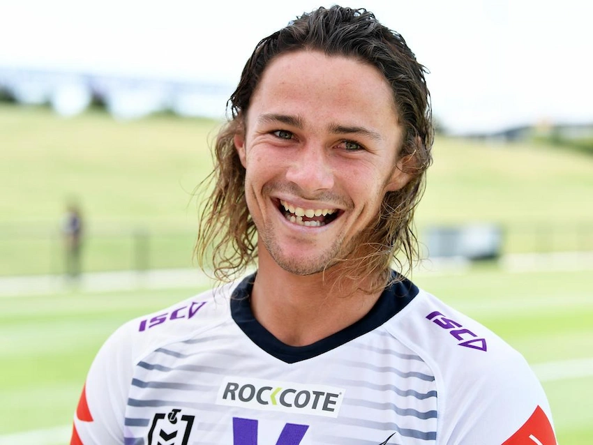 nicho hynes teeth 2016