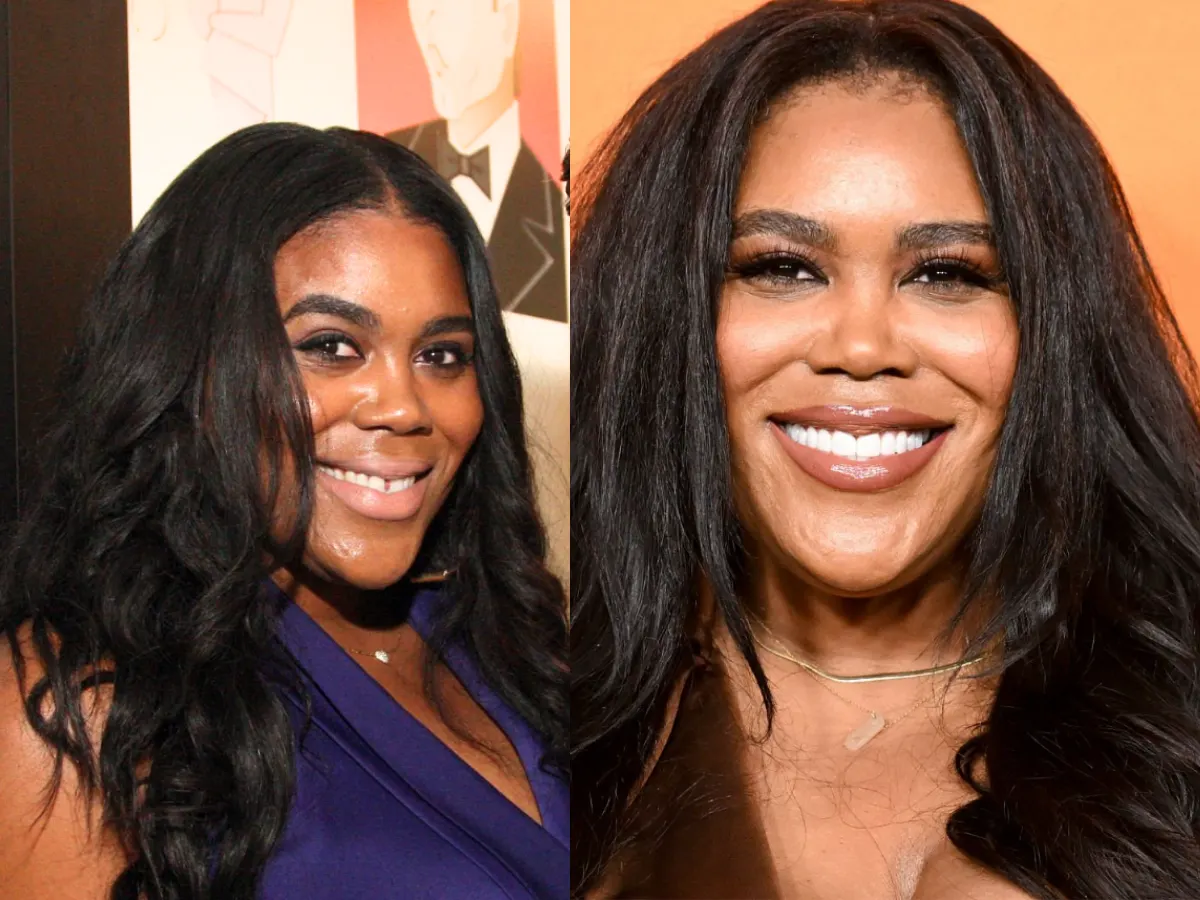 nina parker teeth before after