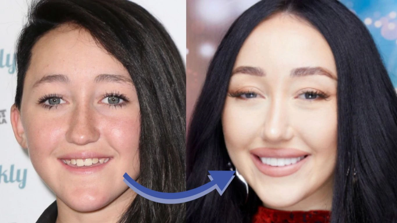 noah cyrus before and after cover