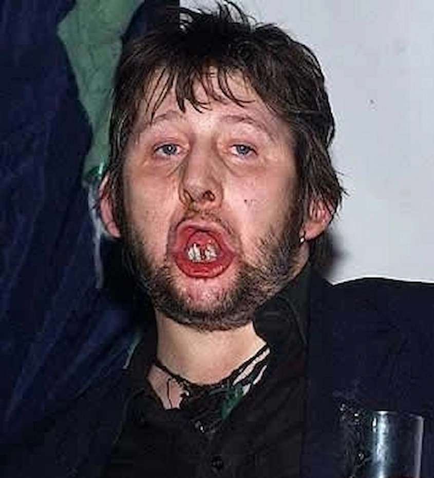 shane macgowan teeth 2000s