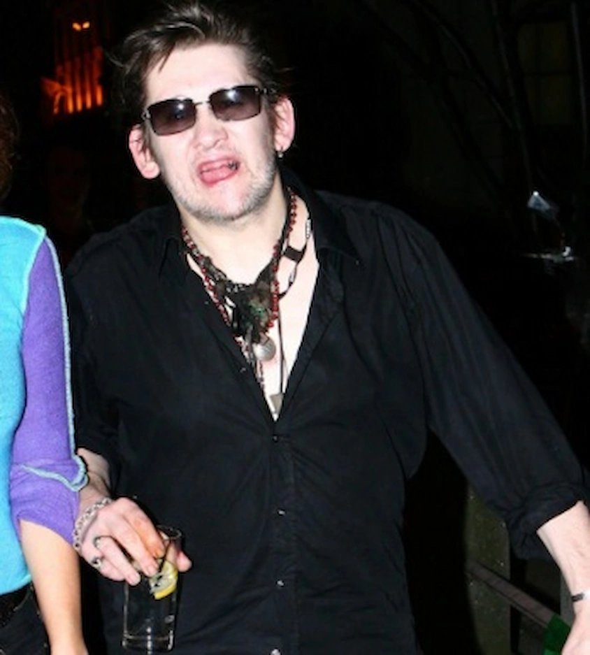 shane macgowan teeth 2005