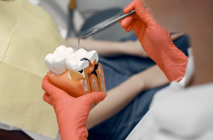 señales de que tus dientes necesitan remineralización