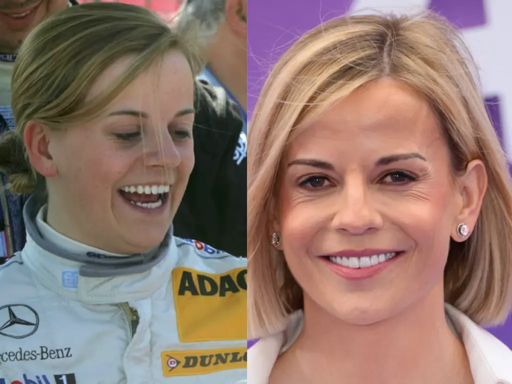 susie wolff zęby przed i po