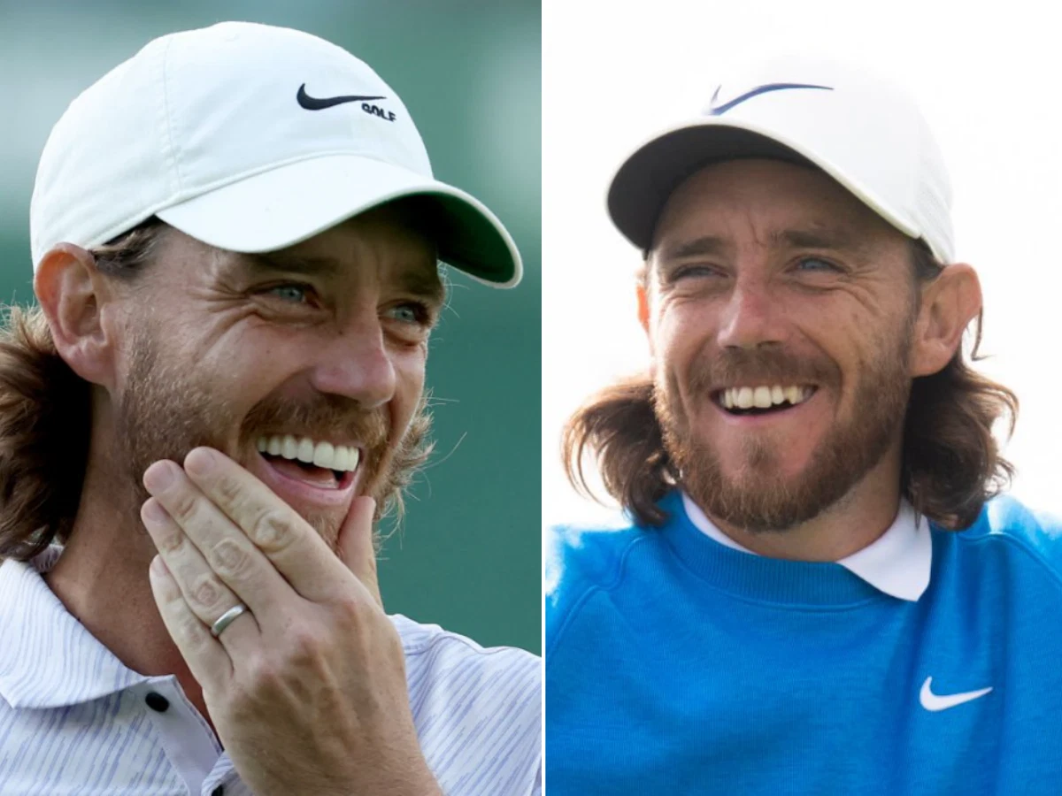 tommy fleetwood teeth before after