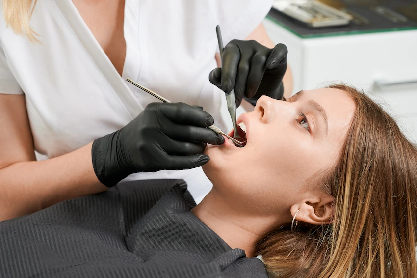 what are dental black triangles causes and treatments