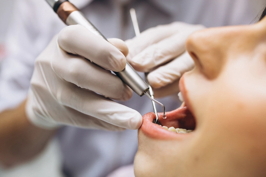 what is pulpitis