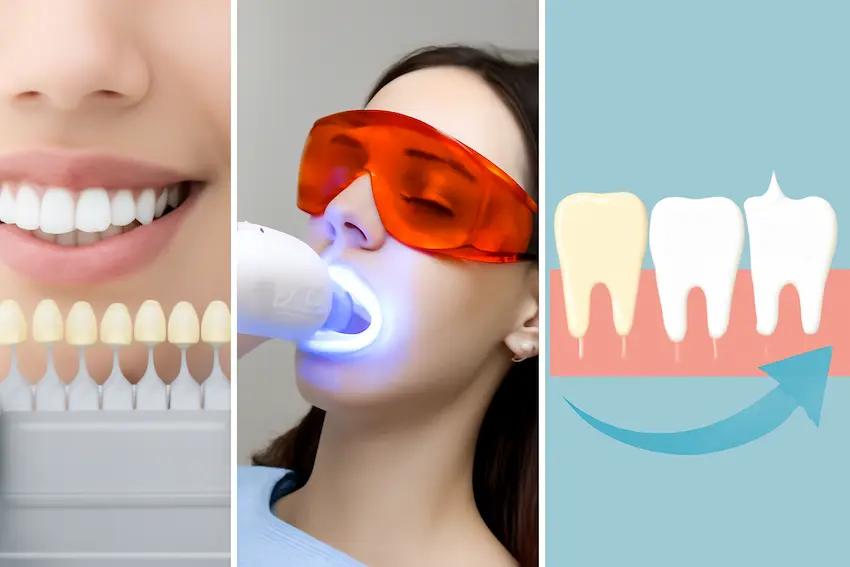 whitining teeth