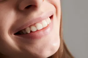 why do gums appear when smiling