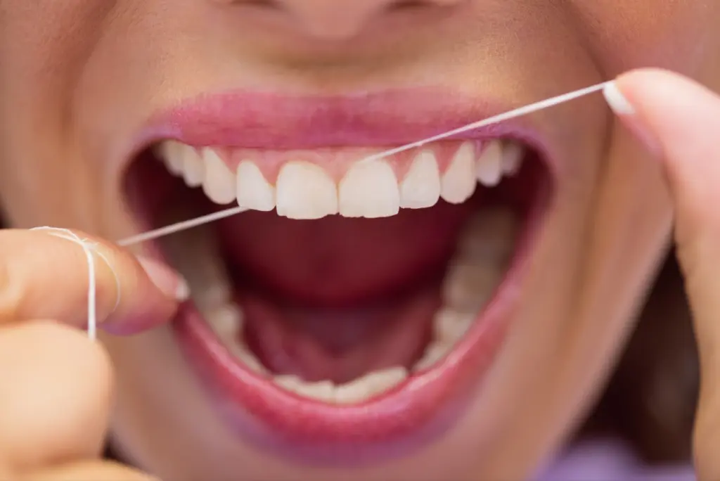 чому кровять ясна під час використання зубної нитки