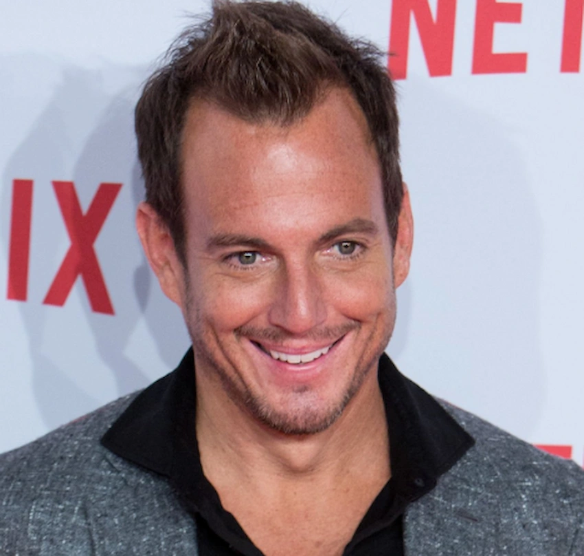 will arnett teeth 2015