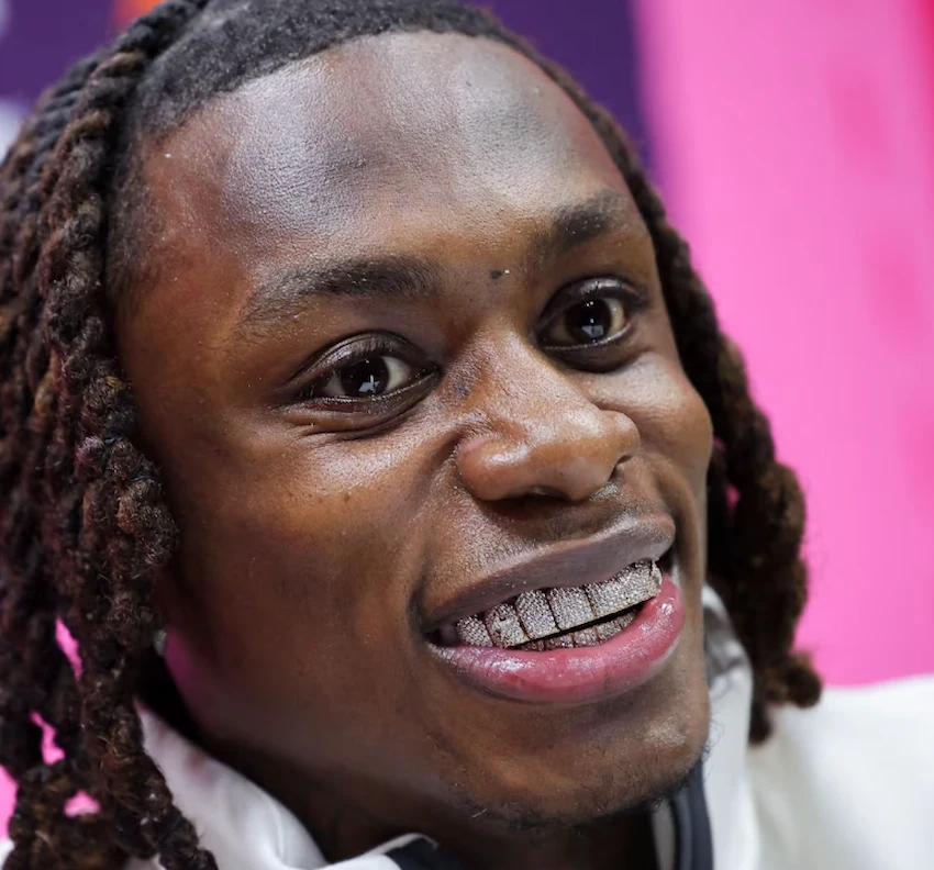 xavier worthy teeth 2025